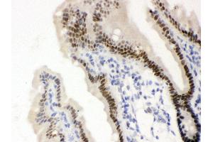 Anti-VDR Picoband antibody, IHC(P) IHC(P): Mouse Intestine Tissue (Vitamin D Receptor antibody  (C-Term))