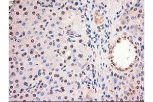 Image no. 5 for anti-Myc Proto-Oncogene protein (MYC) antibody (ABIN1497013) (c-MYC antibody)