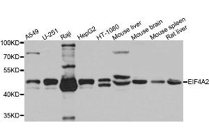 Western blot analysis of extracts of various cells, using EIF4A2 antibody. (EIF4A2 antibody)