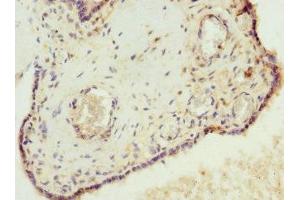Immunohistochemistry of paraffin-embedded human placenta tissue using ABIN7175638 at dilution of 1:100 (VHLL antibody  (AA 1-139))