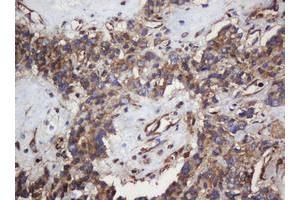 Image no. 1 for anti-SERPINE1 mRNA Binding Protein 1 (SERBP1) (AA 1-262) antibody (ABIN1490675) (SERBP1 antibody  (AA 1-262))