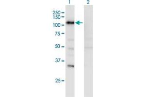 SECISBP2 Antikörper  (AA 106-205)