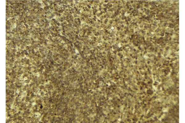 PARP4 antibody  (Internal Region)