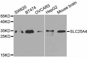 Western blot analysis of extracts of various cell lines, using SLC25A4 antibody. (SLC25A4 antibody  (AA 40-298))