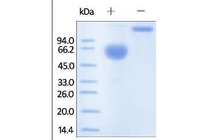Human PROCR, Fc Tag on SDS-PAGE under reducing (R) and no-reducing (NR) conditions. (PROCR Protein (AA 18-209) (Fc Tag))