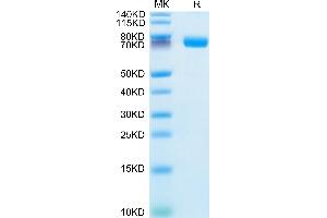 IL1R2 Protein (AA 14-343) (Fc Tag)