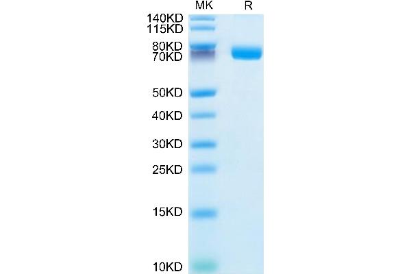 IL1R2 Protein (AA 14-343) (Fc Tag)