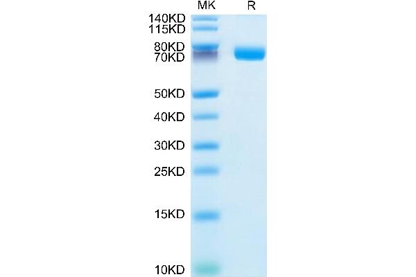 IL1R2 Protein (AA 14-343) (Fc Tag)