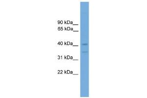 WB Suggested Anti-Foxq1 Antibody Titration:  0.