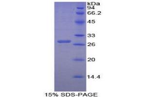 SDS-PAGE (SDS) image for Cystathionine (AA 163-382) protein (His tag) (ABIN2124545)