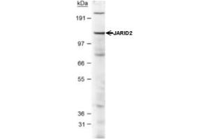 Western Blotting (WB) image for anti-Jumonji, AT Rich Interactive Domain 2 (JARID2) (AA 1-100), (N-Term) antibody (ABIN1951845) (JARID2 antibody  (N-Term))