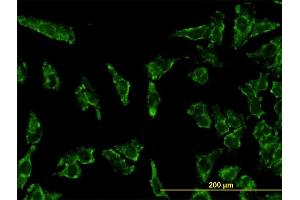 Immunofluorescence of monoclonal antibody to STAT3 on HeLa cell.