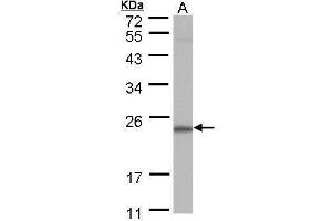 WB Image Sample (30 ug of whole cell lysate) A: A431 12% SDS PAGE antibody diluted at 1:1000 (POLR2G antibody  (full length))