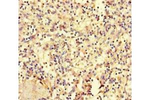 Immunohistochemistry of paraffin-embedded human spleen tissue using ABIN7155778 at dilution of 1:100 (HOXD9 antibody  (AA 38-276))
