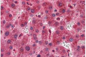 Liver, Human: Formalin-Fixed, Paraffin-Embedded (FFPE) (TIMP2 antibody)