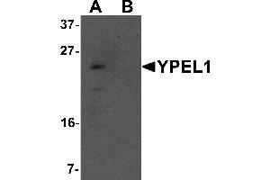 Western blot analysis of YPEL1 in Hela cell lysate with YPEL1 antibody at 1 µg/mL in (A) the absence and (B) the presence of blocking peptide. (YPEL1 antibody  (N-Term))