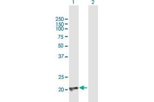 Western Blotting (WB) image for anti-Core-Binding Factor, beta Subunit (CBFB) (AA 1-187) antibody (ABIN947646)
