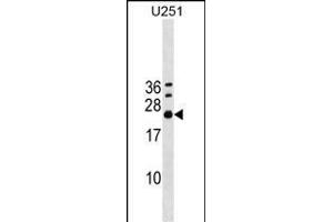 EXOSC4 Antibody (Center) (ABIN1538571 and ABIN2848888) western blot analysis in  cell line lysates (35 μg/lane). (EXOSC4 antibody  (AA 69-96))