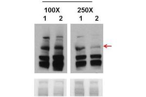 Western Blot with Cell line 293T (Embyonic human kidney cells) tissue (BRCA1 antibody  (Middle Region))