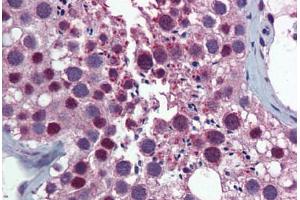 Human Testis: Formalin-Fixed, Paraffin-Embedded (FFPE) (KPNA1 antibody  (AA 1-539))