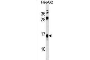 Western Blotting (WB) image for anti-Resistin Like beta (RETNLB) antibody (ABIN3000751) (RETNLB antibody)