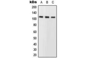 Western blot analysis of PLA2G4A expression in A549 (A), HeLa (B), mouse kidney (C) whole cell lysates.