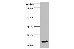 Western blot All lanes: IFNA4 antibody at 2 μg/mL + Mouse kidney tissue Secondary Goat polyclonal to rabbit IgG at 1/10000 dilution Predicted band size: 22 kDa Observed band size: 22 kDa (IFNA4 antibody  (AA 24-189))
