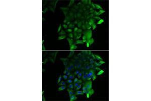Immunofluorescence analysis of U2OS cells using SEPSECS antibody (ABIN6131515, ABIN6147545, ABIN6147546 and ABIN6222910). (SEPSECS antibody  (AA 222-501))