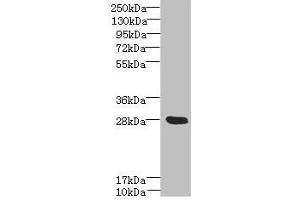 Western blot All lanes: YIPF5 antibody at 5 μg/mL + Mouse liver tissue Secondary Goat polyclonal to rabbit IgG at 1/10000 dilution Predicted band size: 28, 22, 30 kDa Observed band size: 28 kDa (YIPF5 antibody  (AA 1-124))