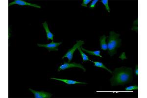 Immunofluorescence of monoclonal antibody to PHB on HeLa cell. (Prohibitin antibody  (AA 1-272))