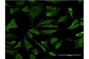 Immunofluorescence of monoclonal antibody to AKT1 on HeLa cell. (AKT1 antibody  (AA 127-200))
