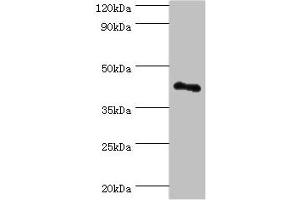 Western blot All lanes: RSAD2 antibody at 8 μg/mL + Jurkat whole cell lysate Secondary Goat polyclonal to rabbit IgG at 1/10000 dilution Predicted band size: 42 kDa Observed band size: 42 kDa