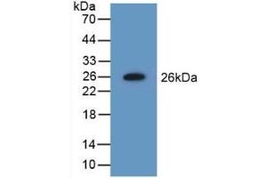 Detection of Recombinant NME5, Mouse using Polyclonal Antibody to Non Metastatic Cells 5, Protein NM23A Expressed In (NME5) (NME5 antibody  (AA 16-210))