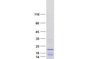 HIST1H2BB Protein (Myc-DYKDDDDK Tag)