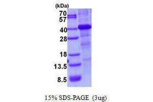 Figure annotation denotes ug of protein loaded and % gel used. (HFE Protein)