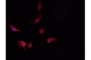 ABIN6269225 staining A-431 cells by IF/ICC. (alpha Adducin antibody)