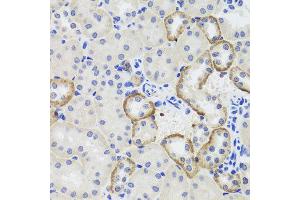 Immunohistochemistry of paraffin-embedded mouse kidney using MTERFD3 antibody at dilution of 1:100 (x40 lens). (MTERFD3 antibody)