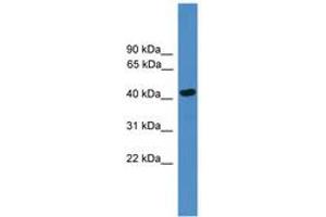 Image no. 1 for anti-serpin Peptidase Inhibitor, Clade B (Ovalbumin), Member 13 (SERPINB13) (AA 180-229) antibody (ABIN6745435)