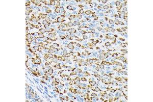 Immunohistochemistry of paraffin-embedded rat ovary using p70 S6 Kinase 2 Rabbit mAb (ABIN7270034) at dilution of 1:100 (40x lens). (RPS6KB2 antibody)