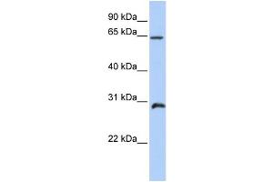 WB Suggested Anti-HOXA5 Antibody Titration: 1 ug/ml Positive Control: Placenta (HOXA5 antibody  (C-Term))