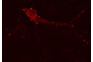 Indirect immunostaining of PFA fixed hippocampus neurons (dilution 1 : 500). (GABRG2 antibody)