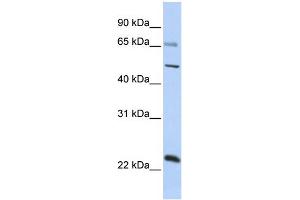 WB Suggested Anti-ZNF597 Antibody Titration:  0. (ZNF597 antibody  (Middle Region))