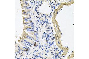 Immunohistochemistry of paraffin-embedded mouse lung using MYH7 antibody (ABIN5974741) at dilution of 1/100 (40x lens). (MYH7 antibody)