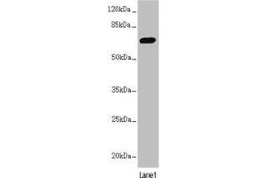 Western blot All lanes: PPP2R3B antibody at 2. (PPP2R3B antibody  (Regulatory Subunit B))