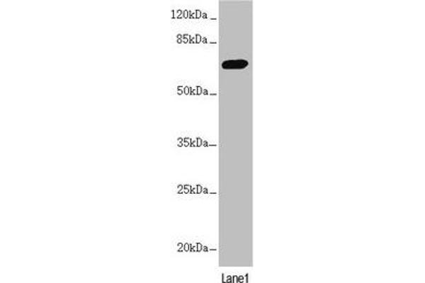 PPP2R3B antibody  (Regulatory Subunit B)