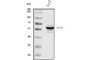 Western blot analysis of TGF Beta Receptor I/TGFBR1 using anti-TGF Beta Receptor I/TGFBR1 antibody (ABIN7601395).