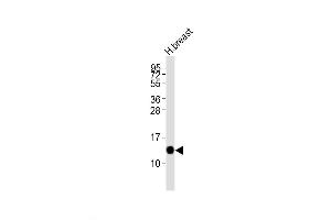 Western Blot at 1:2000 dilution + human breast lysates Lysates/proteins at 20 ug per lane.