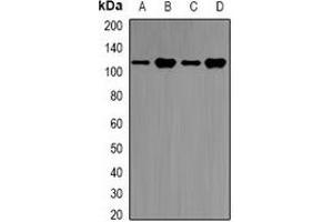 Western blot analysis of E6AP expression in SKOV3 (A), Jurkat (B), mouse brain (C), rat brain (D) whole cell lysates. (ube3a antibody)