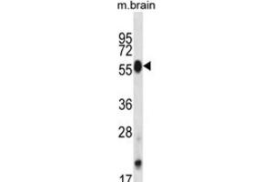 Western Blotting (WB) image for anti-CDC-Like Kinase 4 (CLK4) antibody (ABIN2998111) (CLK4 antibody)