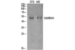 Western Blotting (WB) image for anti-gamma-aminobutyric Acid (GABA) A Receptor, alpha 1 (GABRA1) (Internal Region) antibody (ABIN3181422) (GABRA1 antibody  (Internal Region))